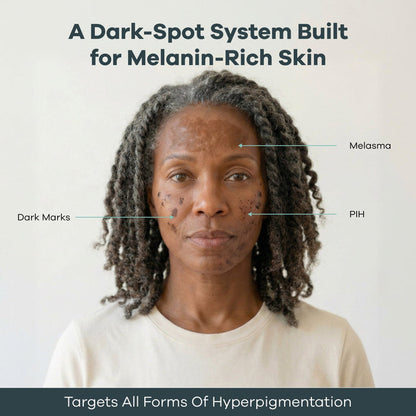 The Micro Infusion System™ For Melanin-Rich Skin